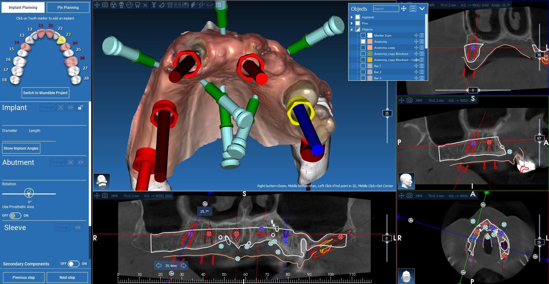 CBCT-знімок щелепи